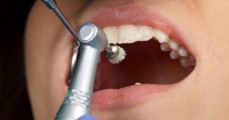 Ottawa Woman Needs $50,000 Dental Care, Not Covered By OHIP